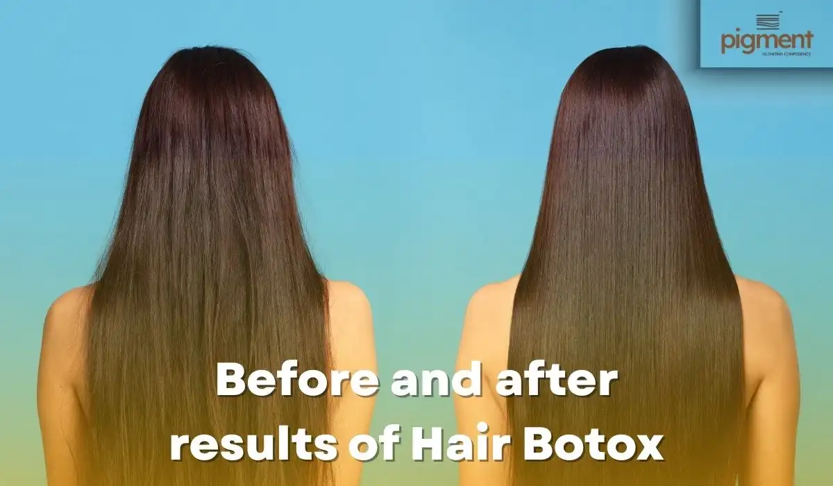 Before and after results of Hair Botox at Pigment Skin & Hair Clinic Bengaluru showing smoother, shinier, healthier hair