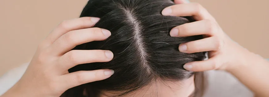 Hair loss and regrowth treatment at Pigment Skin & Hair Clinic Bengaluru focusing on advanced PRP and GFC therapies for stronger, healthier hair