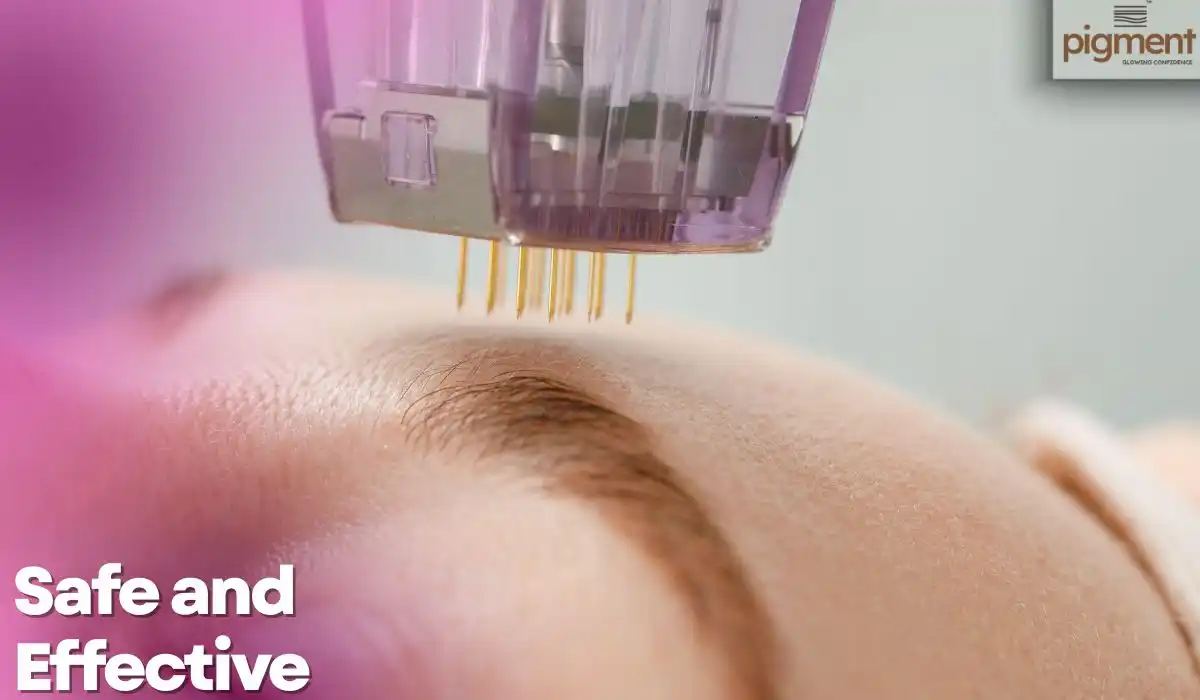 Safe skin tag and wart removal performed by a dermatologist at Pigment Skin & Hair Clinic Bengaluru using advanced, precise treatment methods