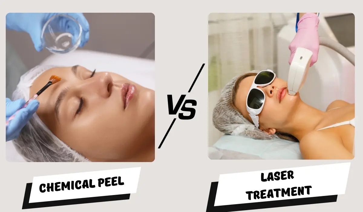 Comparison of chemical peel and laser treatment options for different skin concerns in Bangalore