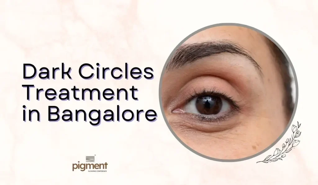 Dermatologist examining under eye dark circles for treatment in Bangalore