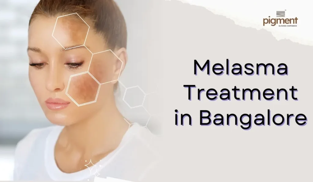 Dermatologist examining melasma patches on the face at a skin clinic in Bangalore