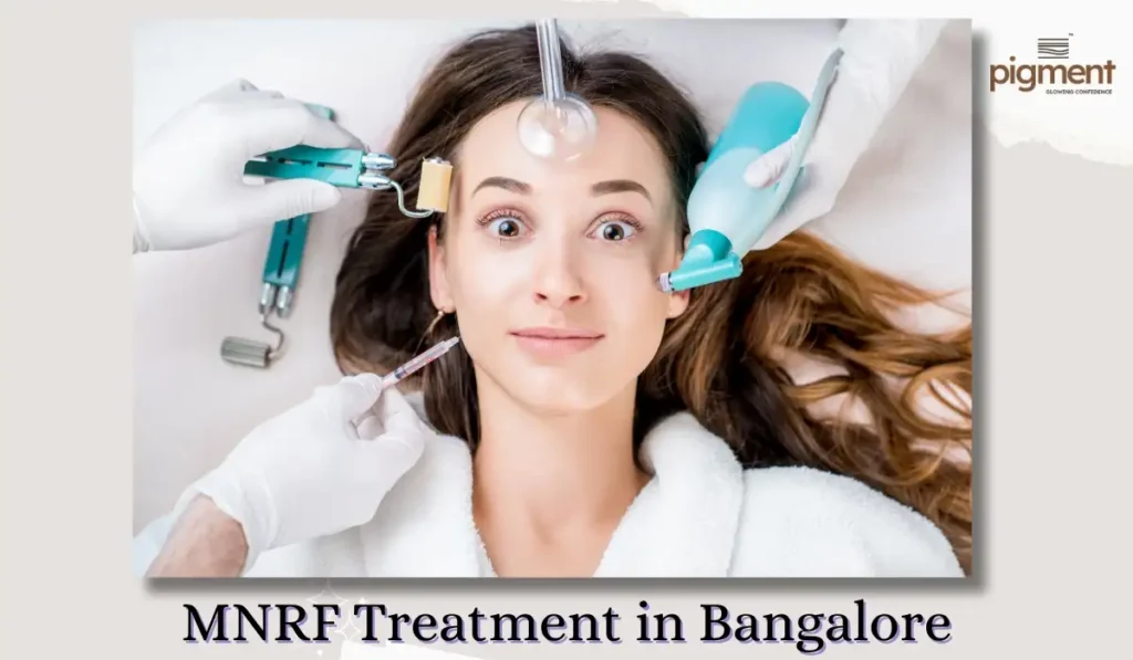 Dermatologist performing MNRF treatment on a patient at a skin clinic in Bangalore