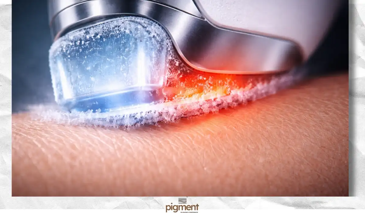 Macro shot showing the frosty sapphire tip of an ice diode laser, demonstrating contact cooling technology for painless hair removal.