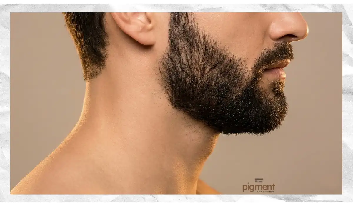 Close up of men's laser beard shaping showing sharp cheek line and clean neck.