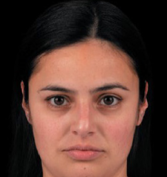 Before Add Contour to Your Cheeks